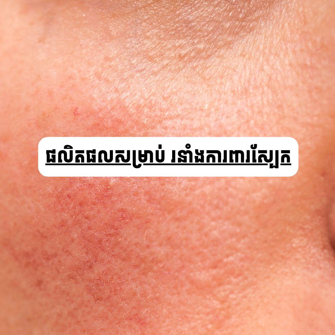 របាំងការពារស្បែក