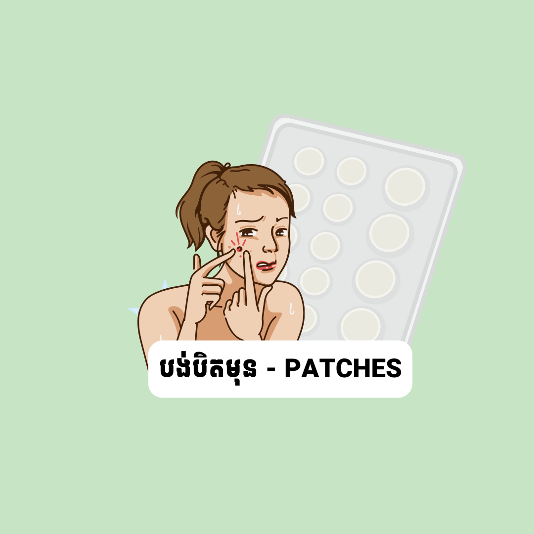 បន្ទះបិតមុន - Patches